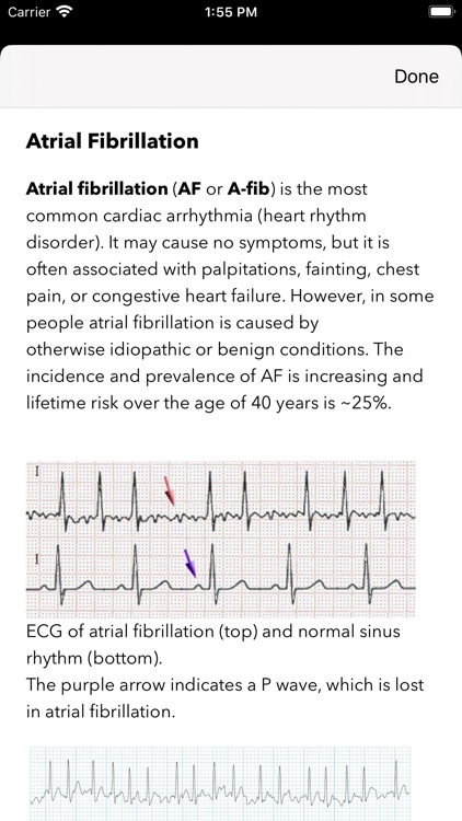 ECG Pro screenshot-6