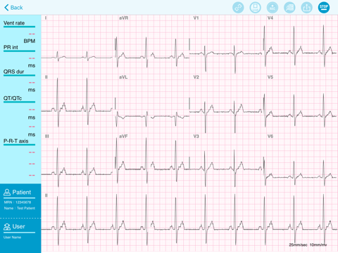 QT ECG Lite screenshot 3