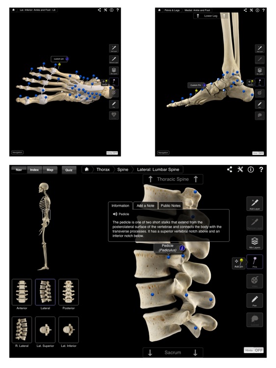 Skeleton System Pro III screenshot-3