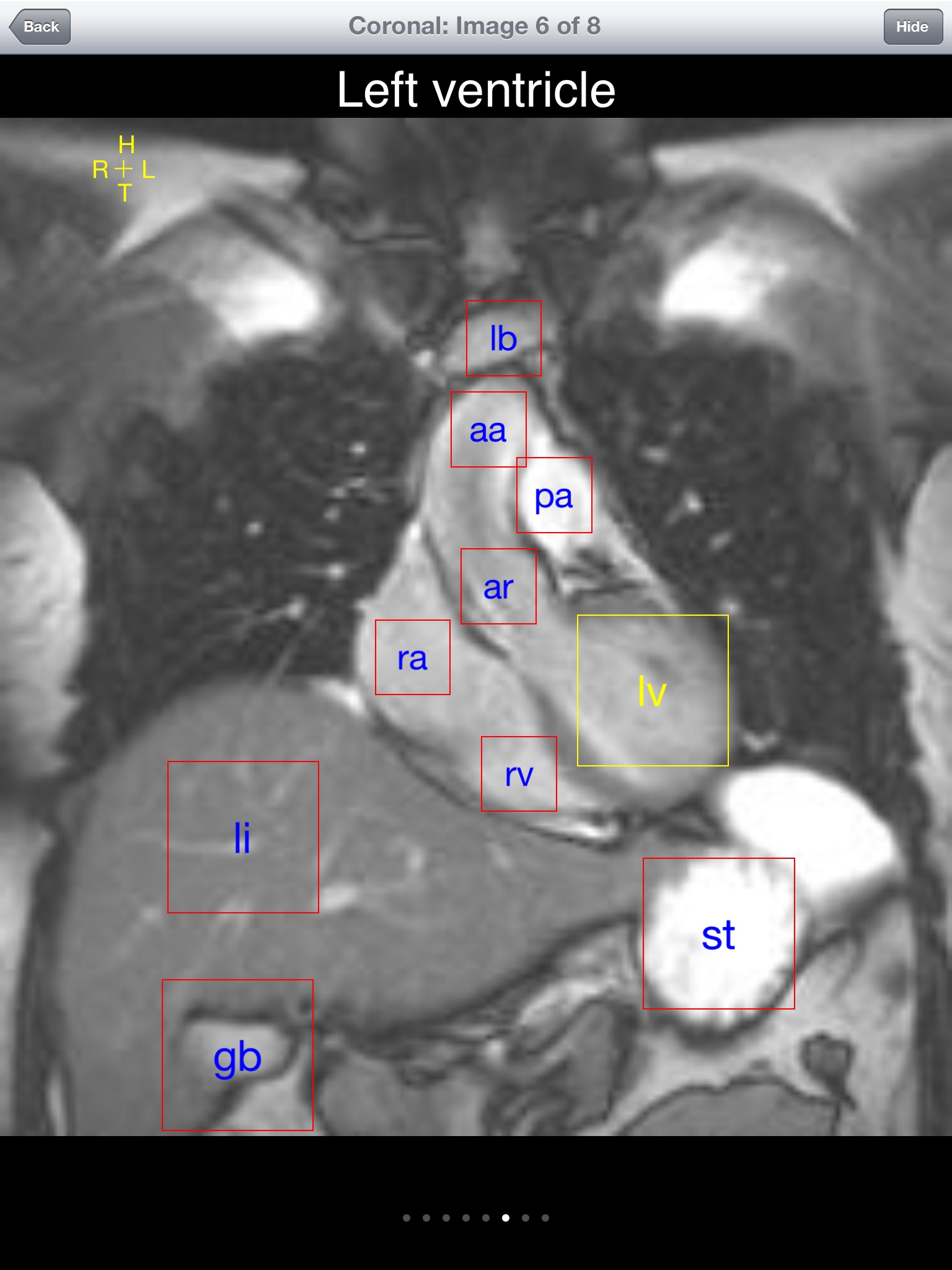 iAnatomy-Cardiac screenshot 3