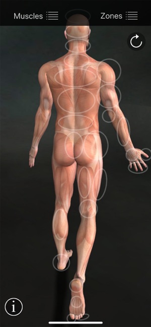 Muscle Trigger Points(圖6)-速報App