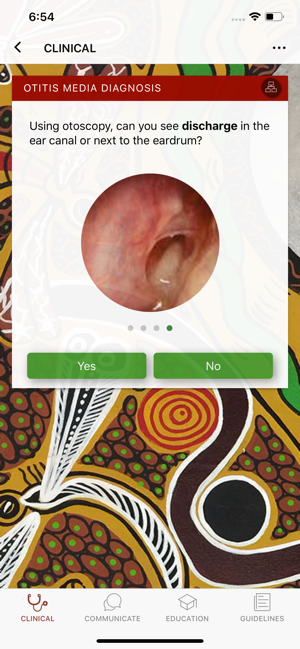 Otitis Media Guidelines(圖2)-速報App