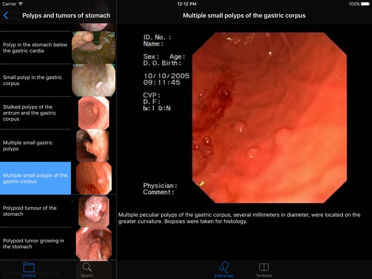 ENDO3®Atlas of GI Endoscopy HD