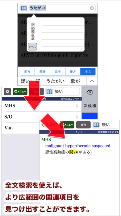 医学略語コンパクト【医歯薬出版】(ONES... screenshot1