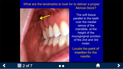 Dental Anesthesia-SecondLook screenshot 3