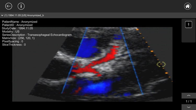 DICOM Viewer : eMma screenshot-5