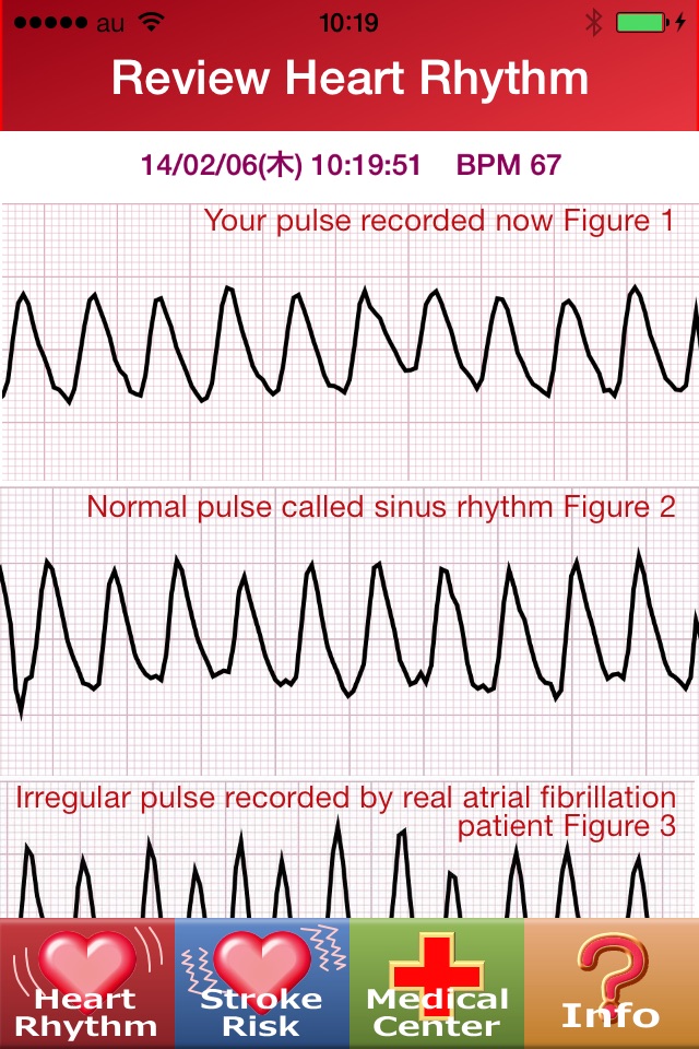 Heart_Rhythm screenshot 3