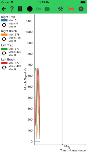 FlexVolt EMG(圖2)-速報App