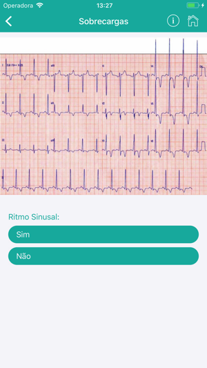 ECG Fácil(圖4)-速報App