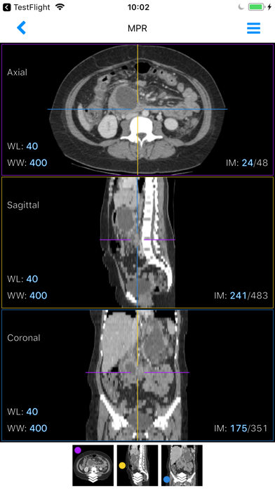 Imaios Dicom Viewer For Android Download Free Latest Version Mod 2021