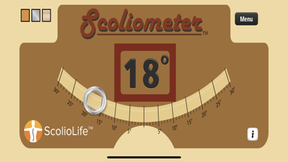 Scoliometer screenshot 3