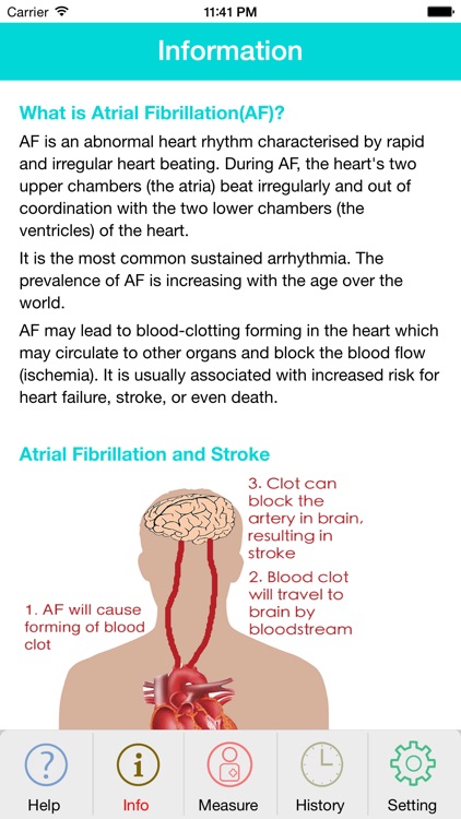 Photo AFib Detector (Lite)