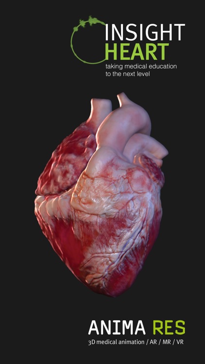 INSIGHT HEART screenshot-5