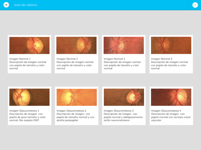 OcularApp(圖3)-速報App