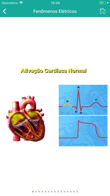 ECG Fácil