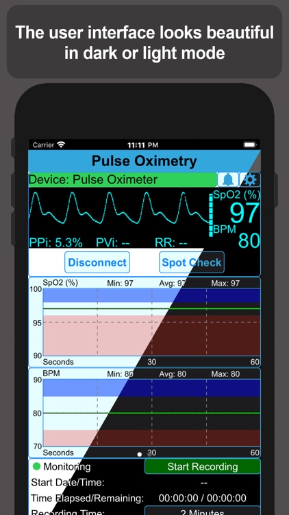 Pulse Oximetry by Victor Galvez