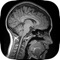 Are you or a loved one about to undergo a medical scan