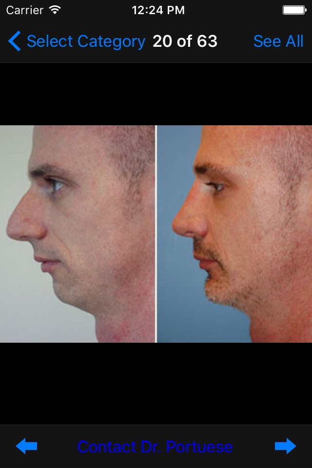 Plastic Surgery & Rhinoplasty screenshot 2