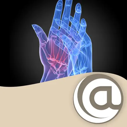 Rheumatoid Arthritis @PoC Читы