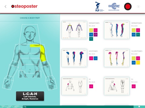 Osteoposter screenshot 3