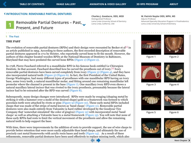 Removable Partial Dentures(圖4)-速報App