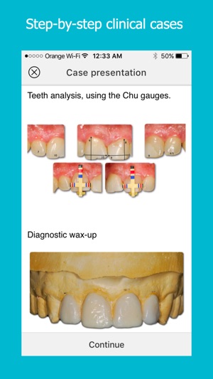 Dental Pearls(圖3)-速報App