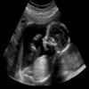 Ultrasound Prank - Fake Pregnancy Trick
