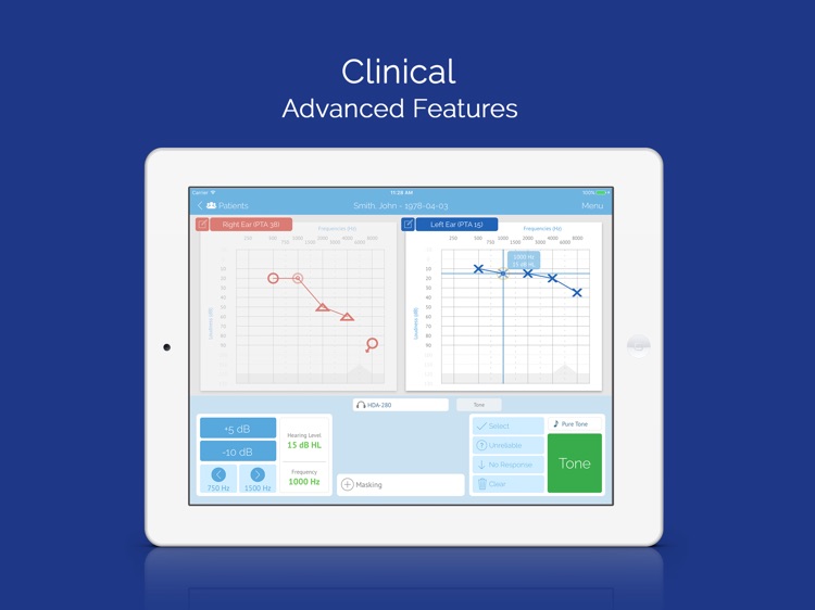 SHOEBOX Audiometry Pro