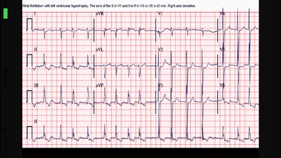 ECG Interpreter Screenshot 5