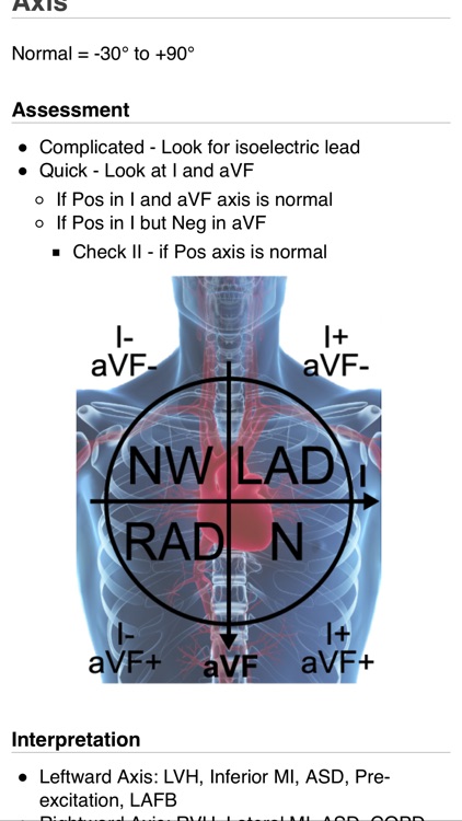ECG Guide