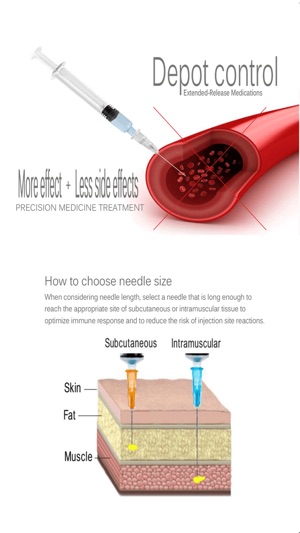 Intramuscular Injection Avoid Painful In