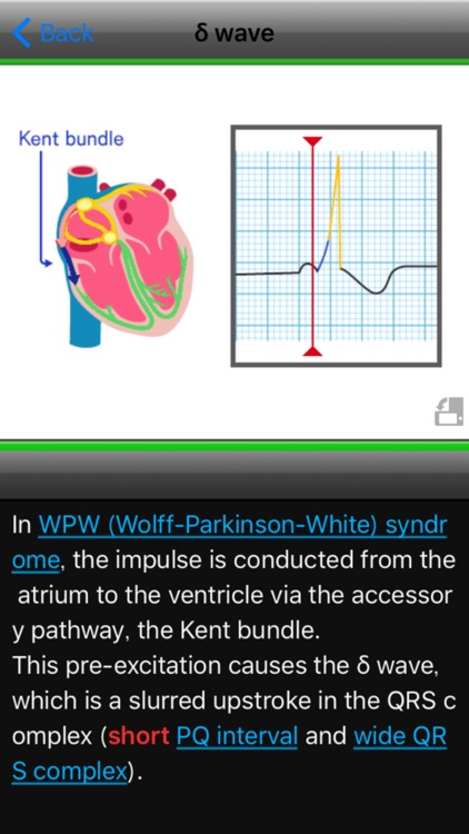 easy ECG training screenshot-3