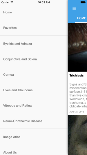 Ocular Disease Handbook(圖3)-速報App