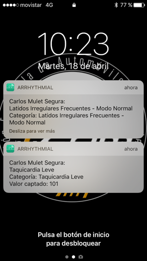 Arrhythmial(圖3)-速報App