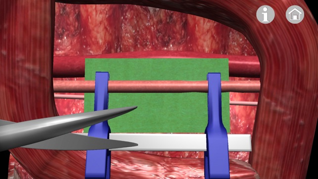 Microsurgery 3D(圖1)-速報App