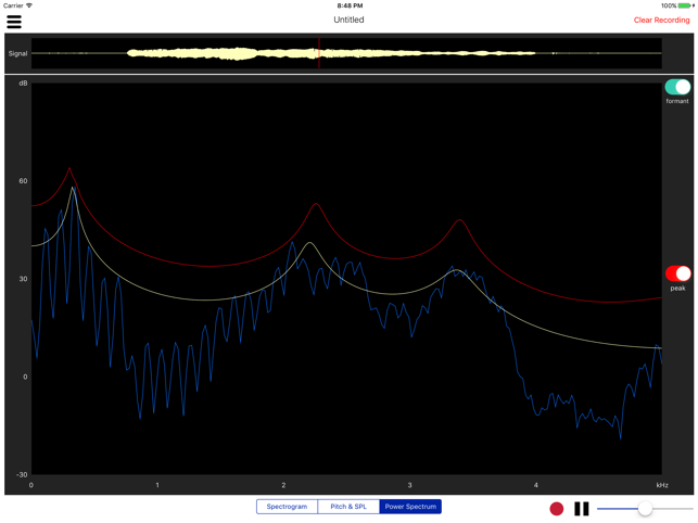 Voiceprint - Estill Voice Training(圖3)-速報App