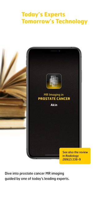 MR Imaging in Prostate Cancer(圖1)-速報App