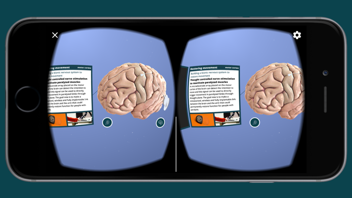 Wyss Center Neurotech Brain