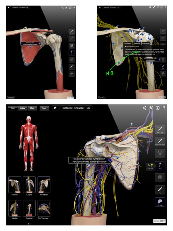 Shoulder Pro III for iPad screenshot-3