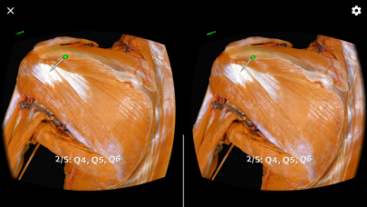 MacAnatomy VRBR screenshot 4