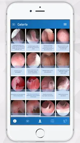 Game screenshot Hysteroscopy News apk