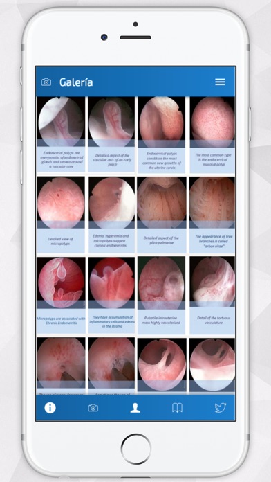 How to cancel & delete Hysteroscopy News from iphone & ipad 2