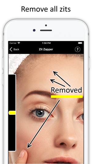 Zit Zapper - Remove Pimples(圖5)-速報App