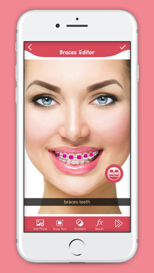 Braces Photo Editor - Booth(圖5)-速報App