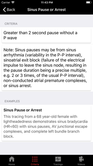 ECGsource(圖1)-速報App