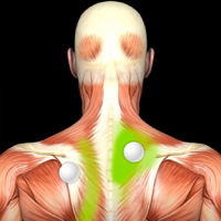 Muscle Trigger Points Guide  Reference