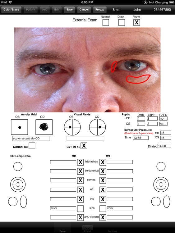 OphthyChart screenshot-3
