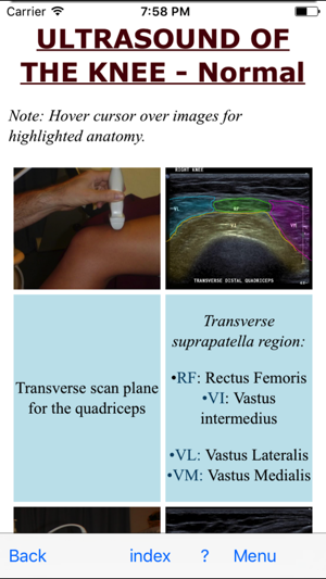 Ultrasoundpaedia(圖4)-速報App