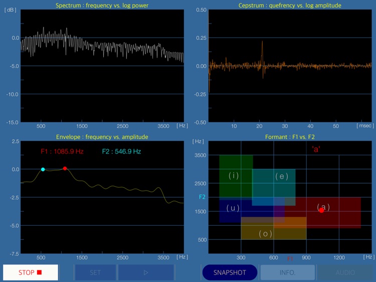 Onmon - Audio & Voice Analyzer screenshot-4