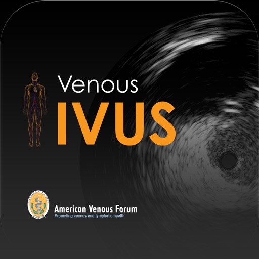 Venous IVUS